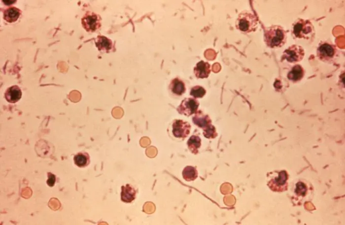 This photomicrograph shows the Shigella bacteria. (Hawaii Department of Health)
