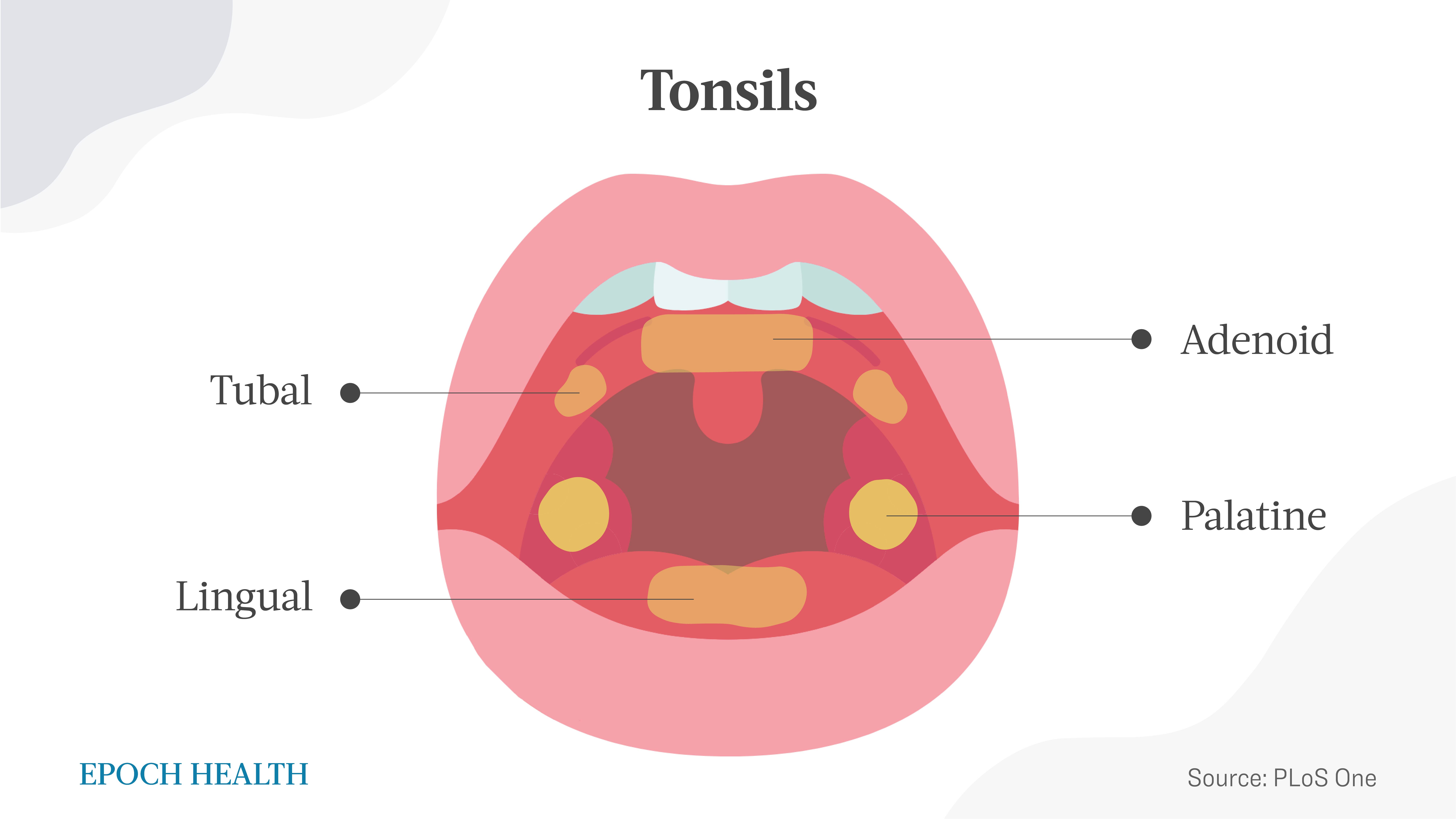 The four parts of the tonsils form a ring-like structure known as Waldeyer’s ring. (The Epoch Times)