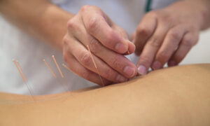 Acupuncture Therapy Effective in the Prevention and Treatment of Diabetes: Studies