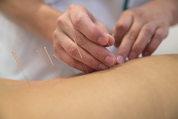 NextImg:Acupuncture Therapy Effective in the Prevention and Treatment of Diabetes: Studies