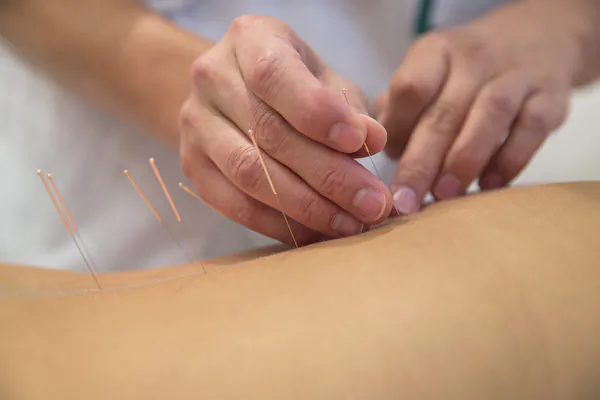 Acupuncture Therapy Effective in the Prevention and Treatment of Diabetes: Studies