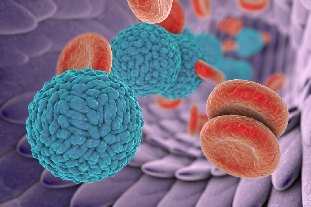 Cancer cells wake up and spread when people sleep. (Kateryna Kon/Shutterstock)