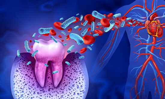 periodontitis-the-epoch-times