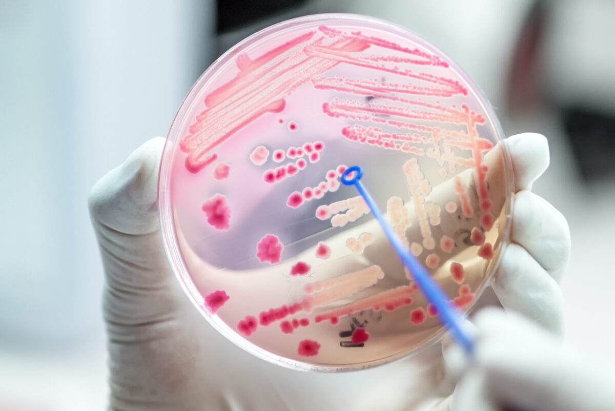 NextImg:As Antibiotic-Resistance Threat Grows, Treatment Is Becoming ‘More Complicated’: Expert