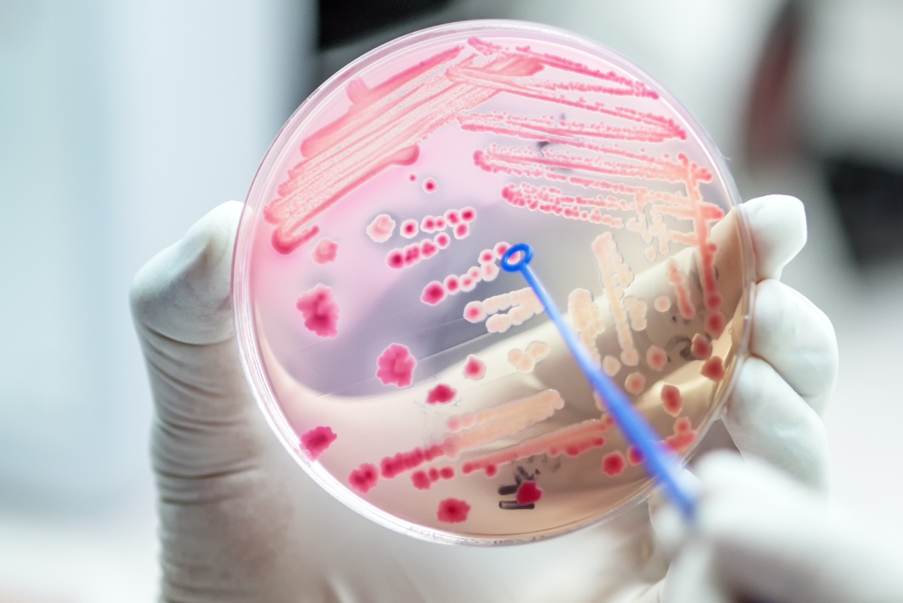 As Antibiotic-Resistance Threat Grows, Treatment Is Becoming 'More Complicated': Expert - Vimarsana News