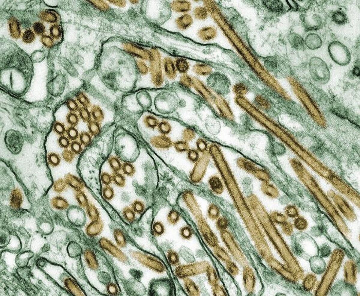 NextImg:Toronto Zoo Closes Aviaries After Bird Flu Case Detected at Southern Ontario Farm