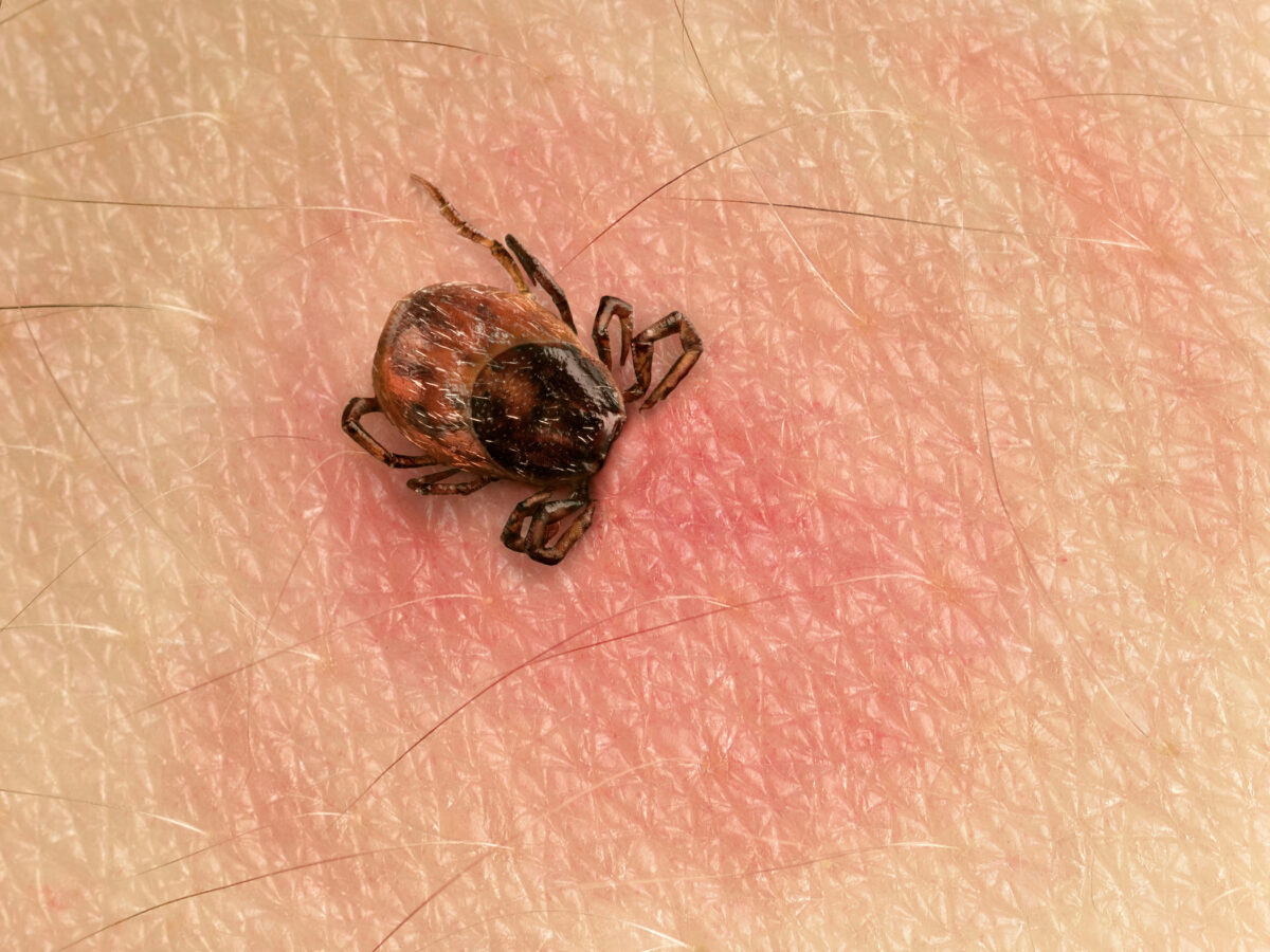NextImg:Lyme: The Government Has Been Making Bugs More Deadly