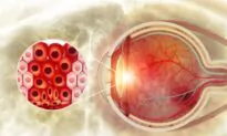 Vision Impairments in Patients After COVID-19 Vaccination, Doctors Caution Possible Risks