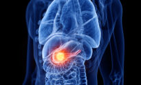 6 Daily Approaches to Preventing Pancreatic Cancer