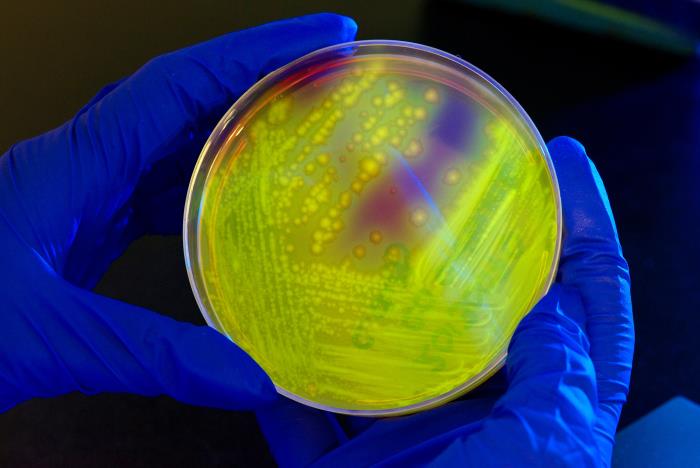 CDC Identifies More Deaths Linked to Drug-Resistant Bacteria in Recalled Product