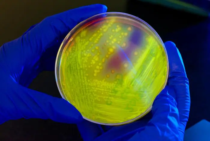 A petri dish culture shows a bacterial culture as seen in a file photo. (CDC/Melissa Dankel)