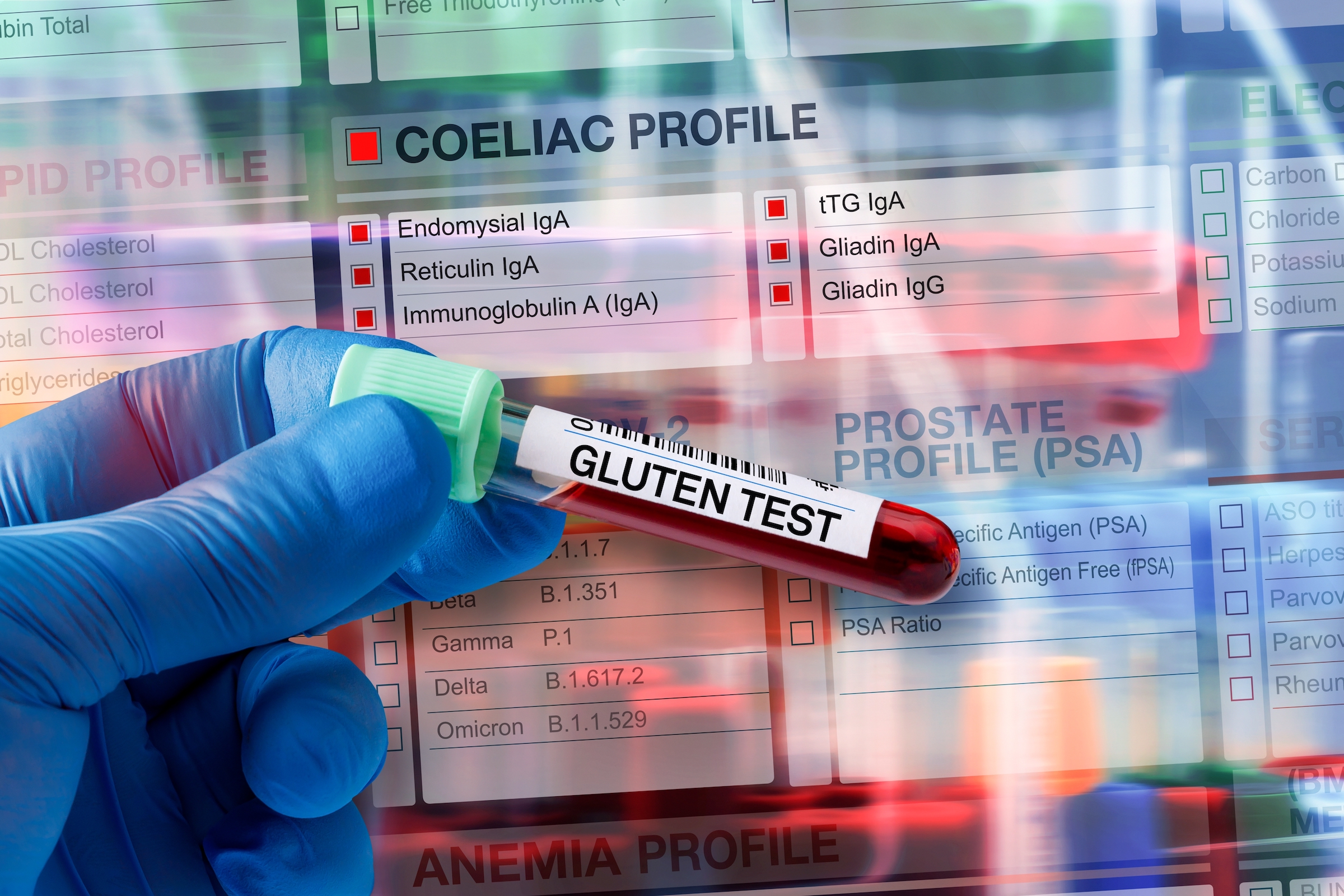 Medical Warning: Gluten Allergies Affect Everyone - Vimarsana News