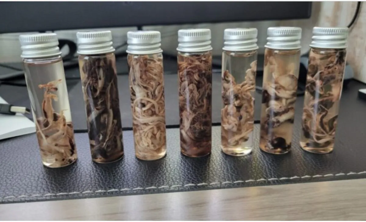Vials of embalmed fibrous clots. (Courtesy of John O'Looney)