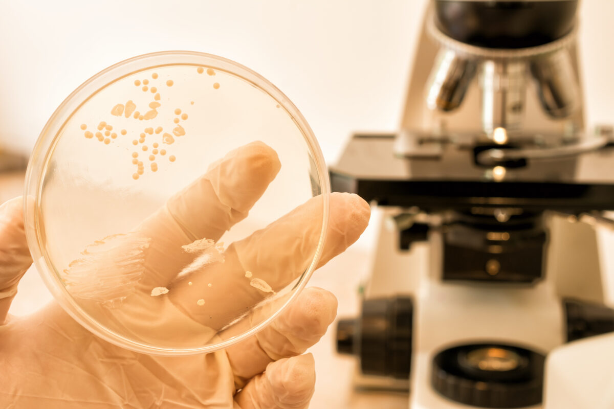 NextImg:Candida: A Fungus We All Carry That Can Lead to Most Common Fungal Infections, Tips to Fight It