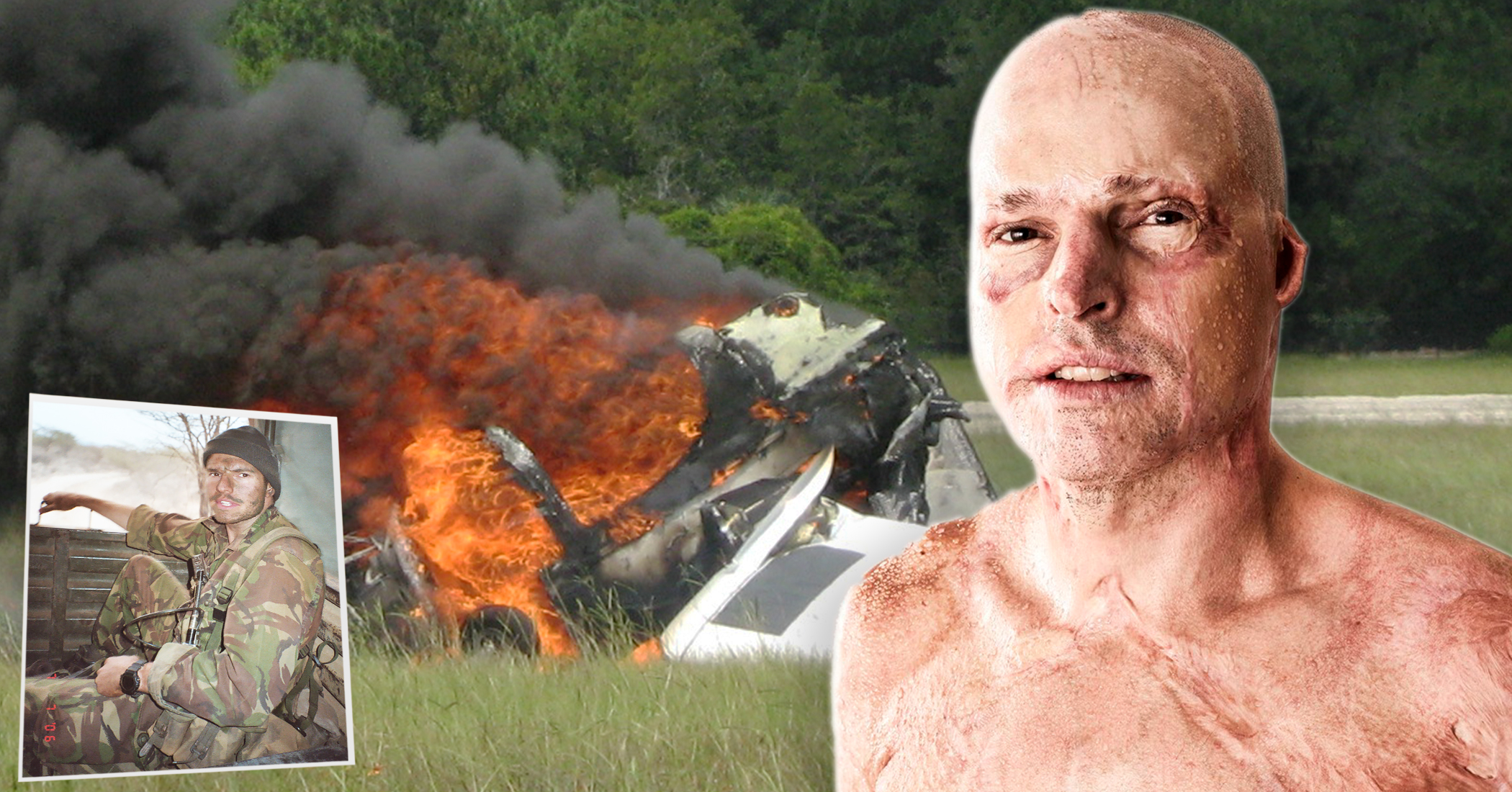 NextImg:‘Life on a thread’: Pilot with 63 percent third-degree burns survived his cockpit catching fire