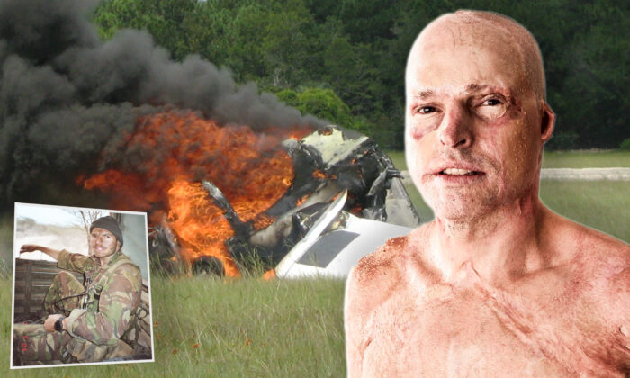 'Life on a Thread': Pilot With 63 Percent Third-Degree Burns Survived His Cockpit Catching Fire