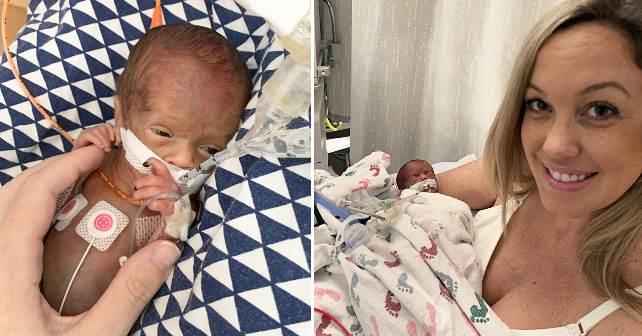 NextImg:Preemie who looked like a tiny doll at birth turns 2—here's how this little miracle is doing now