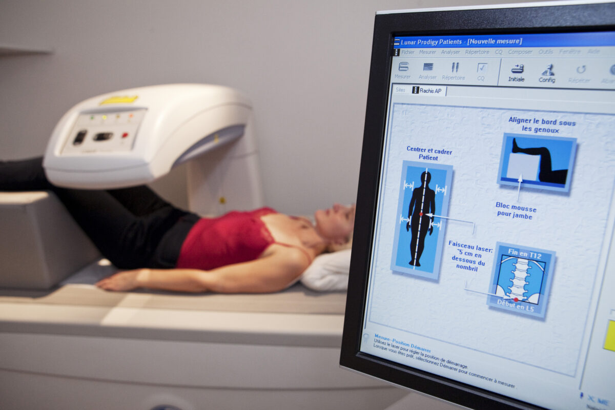 NextImg:The Manufacturing of Bone Diseases: The Story of Osteoporosis and Osteopenia