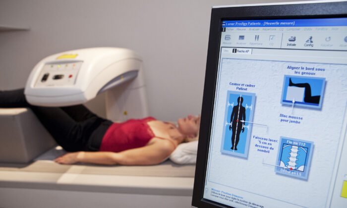 The Manufacturing of Bone Diseases: The Story of Osteoporosis and Osteopenia