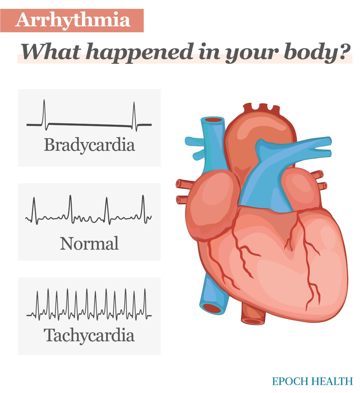 Why Can I Feel My Heartbeat When I Lay On My Left Side