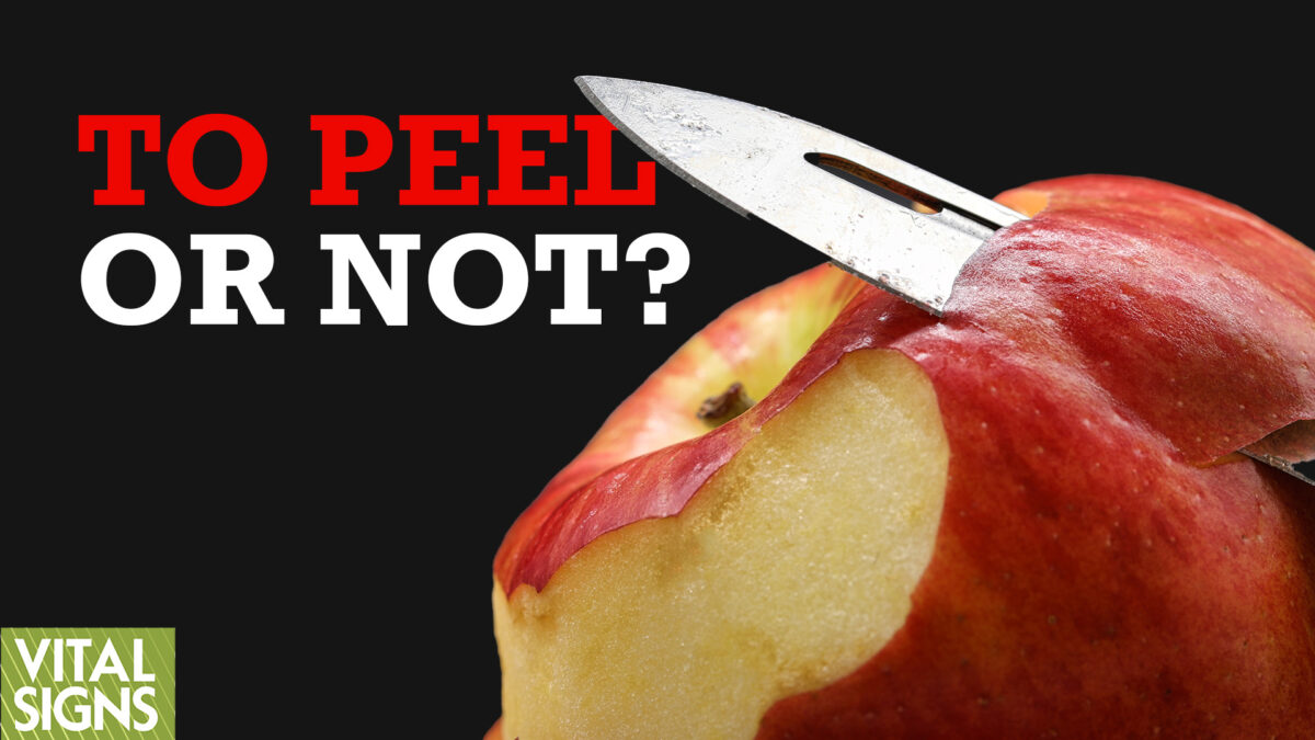 NextImg:Organic vs. Non-Organic Apples: Which is Better for Health and Nutrition?