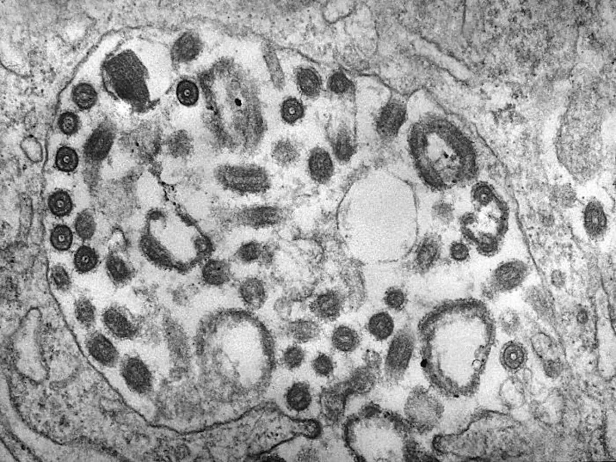 This transmission electron microscopic (TEM) image in 1975 of an undisclosed tissue sample, reveals the presence of numerous Marburg virus particles. (CDC/Dr. Fred Murphy; Sylvia Whitfield)