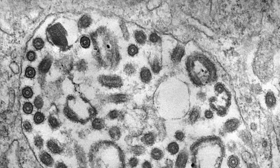 CDC Warns About Deadly Marburg Virus Amid Outbreaks in Africa