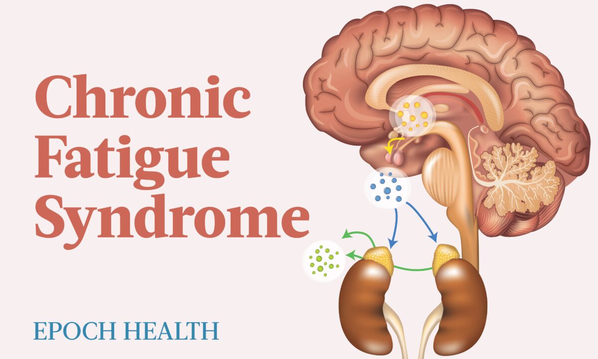 The Essential Guide to Chronic Fatigue Syndrome: Symptoms, Causes, Treatments, and Natural Remedies