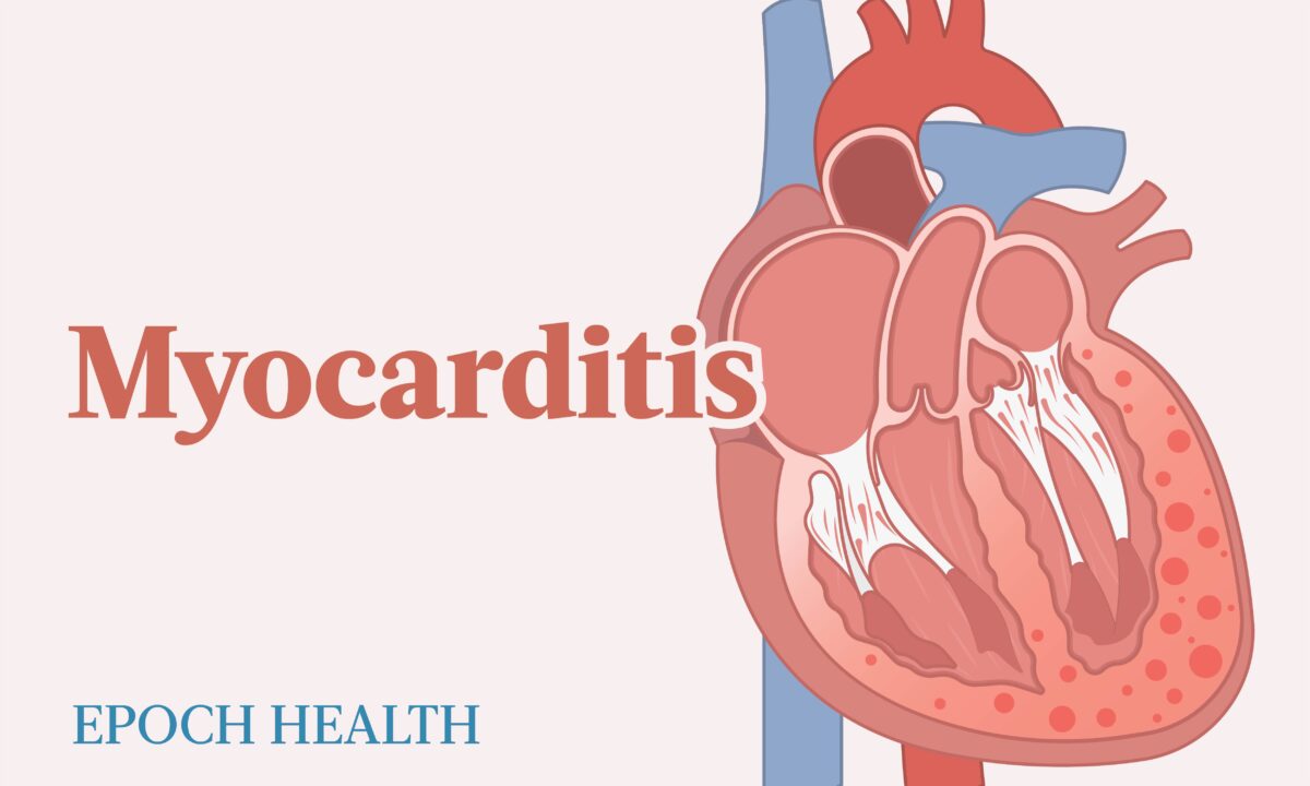 The Essential Guide to Myocarditis Symptoms, Causes, Treatments, and