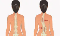 3 Simple Moves to Improve Spinal Health and Correct Scoliosis