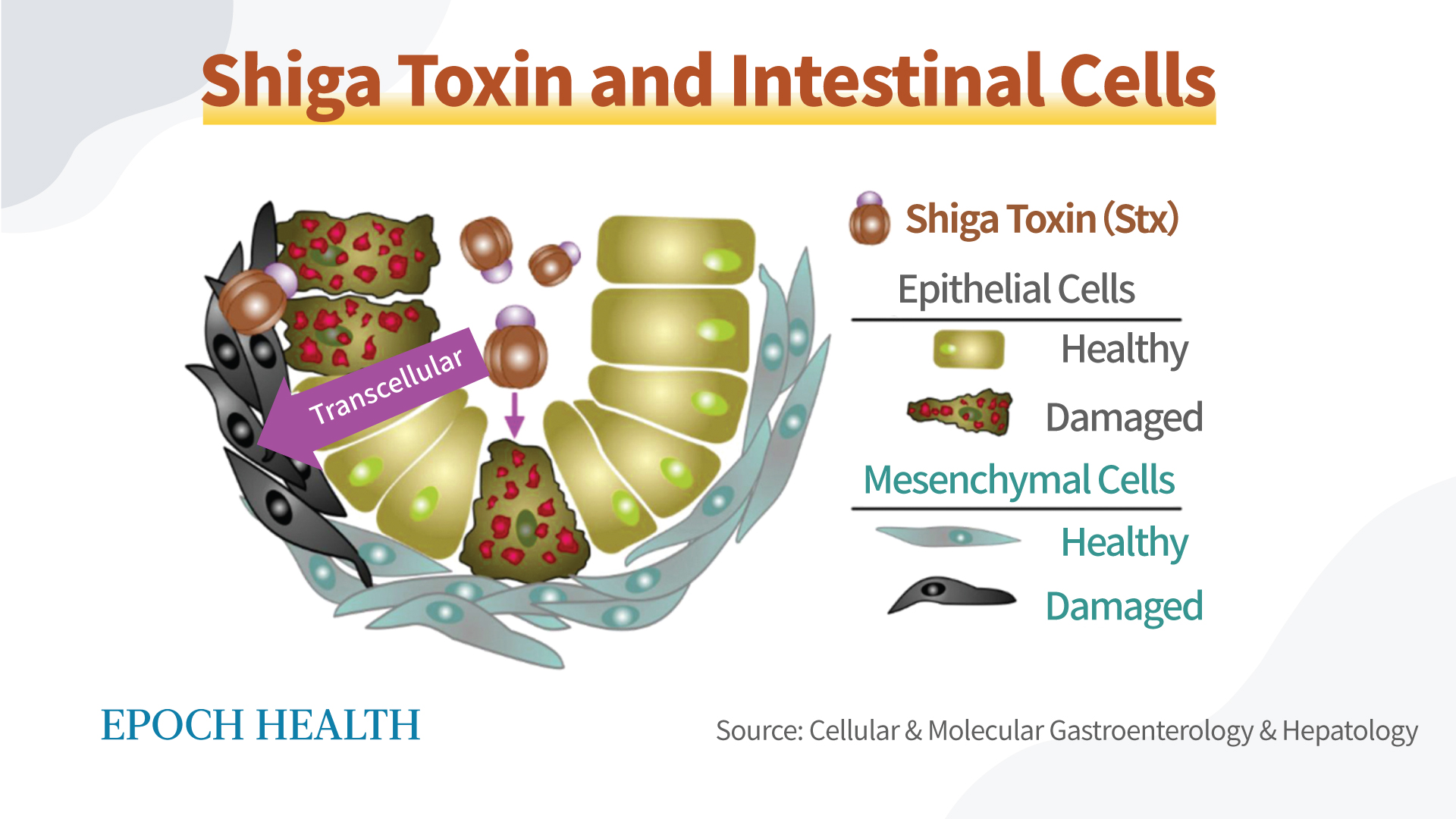 The Epoch Times The E Coli Super Pathogens You Should Know About   Id5175223 Intestine STEC 