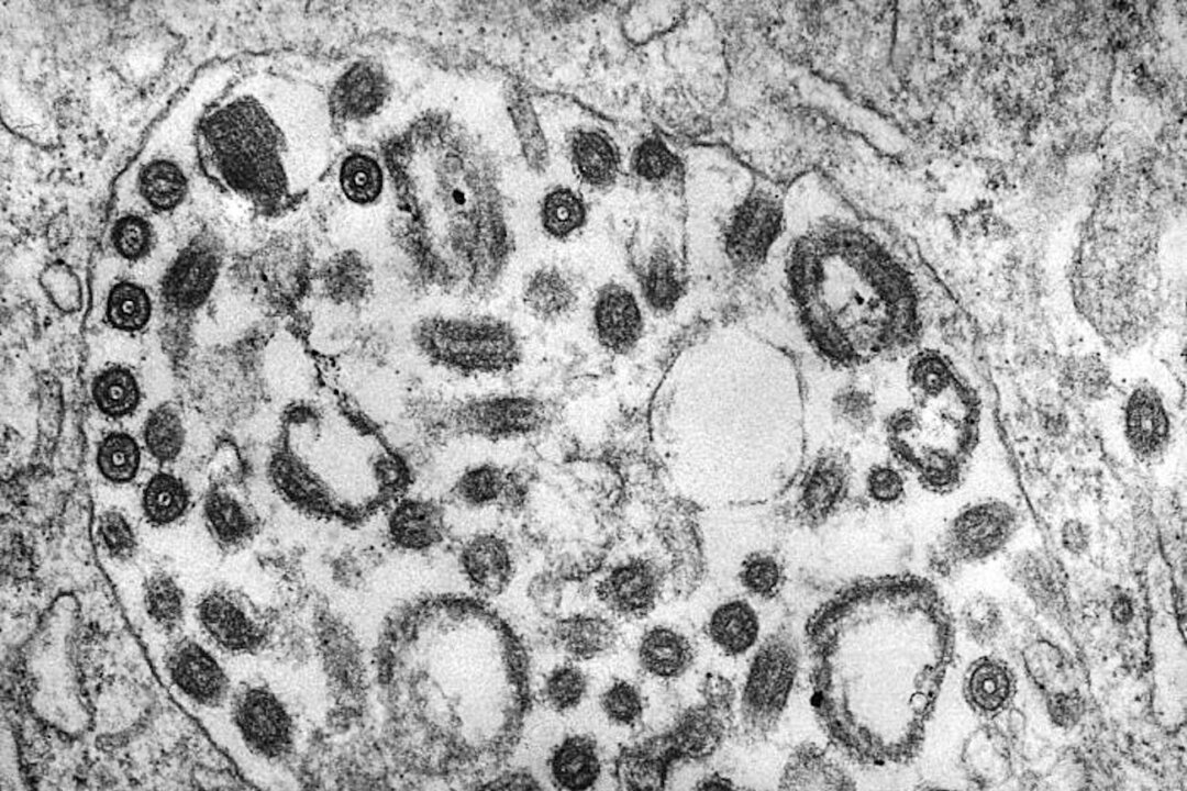 This transmission electron microscopic (TEM) image in 1975 of an undisclosed tissue sample, reveals the presence of numerous Marburg virus particles. (CDC/Dr. Fred Murphy; Sylvia Whitfield)