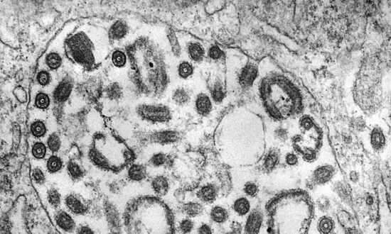 CDC Issues Health Alert to Doctors Over Deadly Ebola-Like Virus