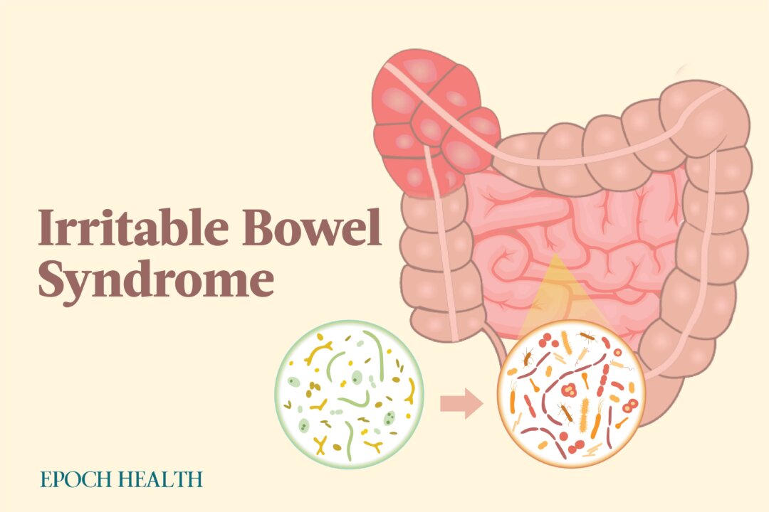The primary ways to treat IBS are lifestyle and dietary changes. (The Epoch Times)