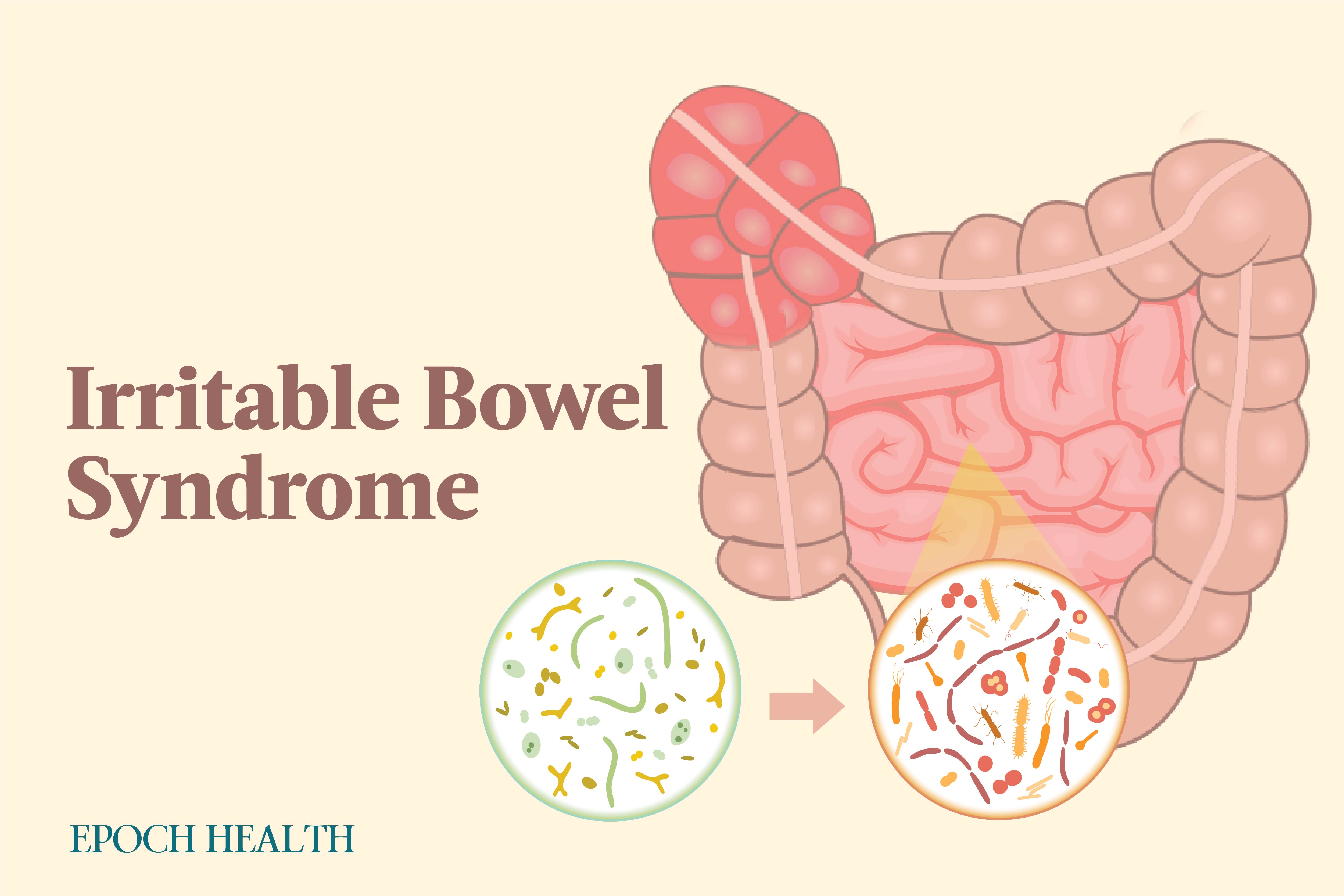 The Essential Guide to Irritable Bowel Syndrome (IBS): Symptoms, Causes, Treatments, and Natural Remedies