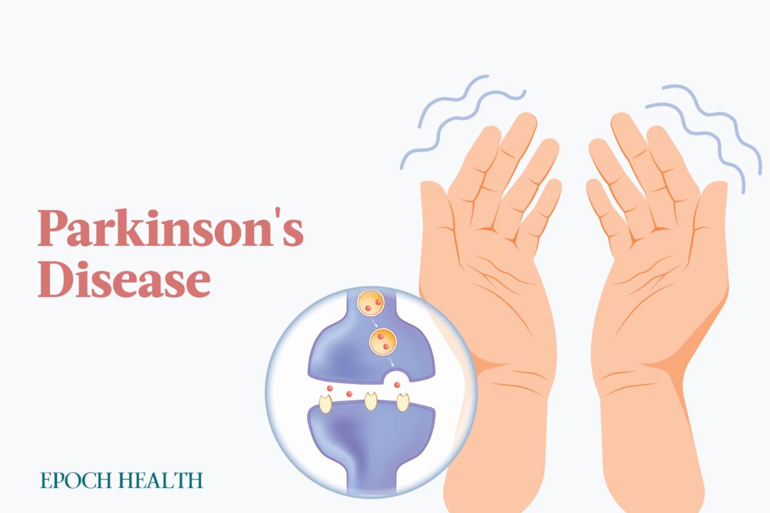 The incidence of Parkinson's disease cases has gone up by about 50 percent in recent years, with about 90,000 cases diagnosed annually. (The Epoch Times)