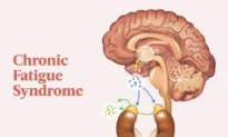 The Essential Guide to Chronic Fatigue Syndrome: Symptoms, Causes, Treatments, and Natural Remedies