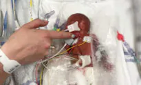 Baby Born Weighing Less Than a Loaf of Bread and Given Only 10 Percent Survival Chance, Celebrates First Birthday