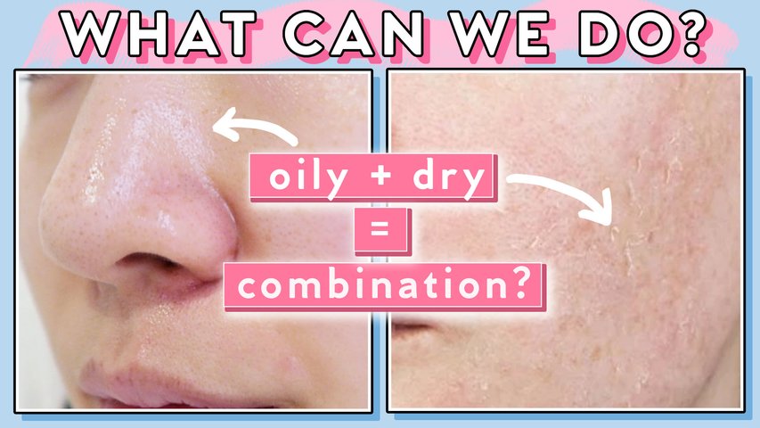 NextImg:Your Pores Are Oily and Your Skin Is Dry at the Same Time? Combination Skin Tips!