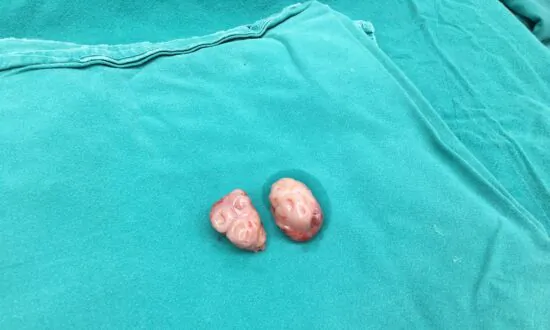 Many People Have Removed an Important Body Part, Which May Increase 4 Cancer Risks