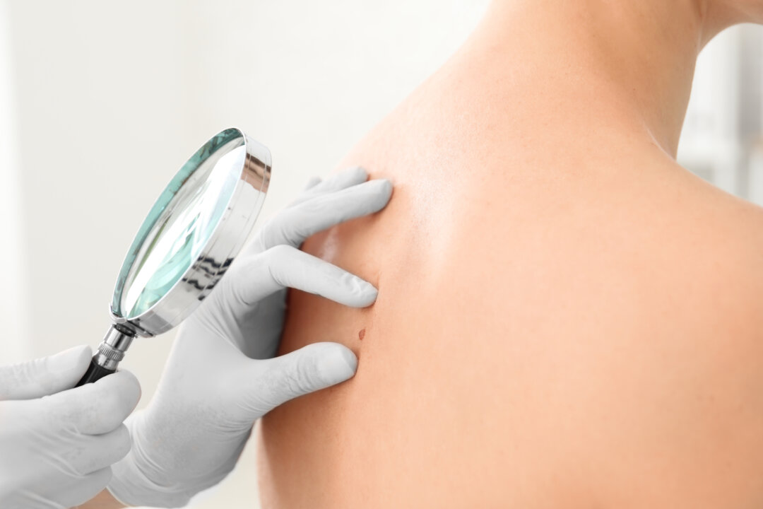 Oncologist examining patient with magnifier in clinic. Cancer awareness. (Shutterstock)