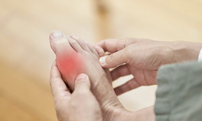 Don't Let Gout Control Your Life: Try This Ancient Therapy for Fast Relief