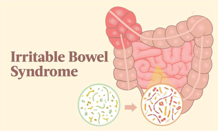 Irritable Bowel Syndrome is More Common Than You Think, and Your Stool Shape Could be a Clue