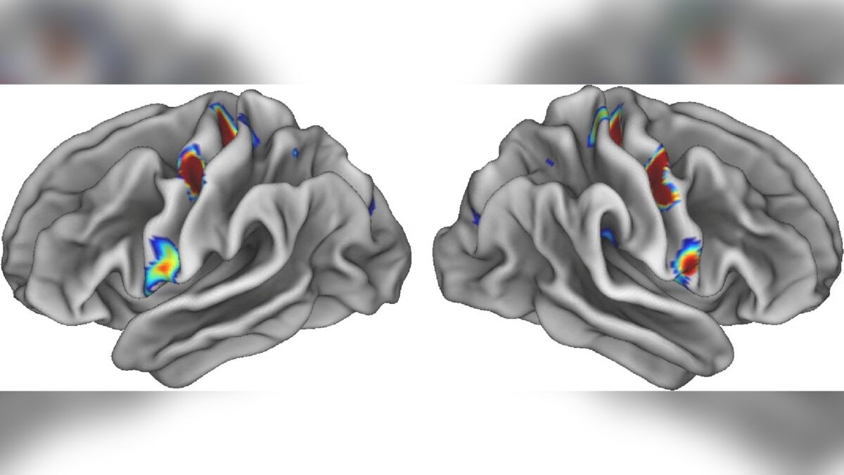 NextImg:Scientists Identify Mind-Body Nexus in Human Brain