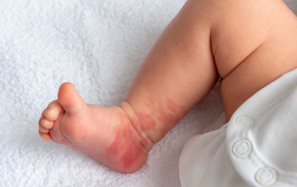NextImg:Journey of a Birthmark: Let's Take a Peek Into Our Past Lives