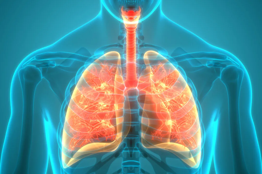 Most COVID Lung Abnormalities Heal Over Time, New Guidelines Confirm