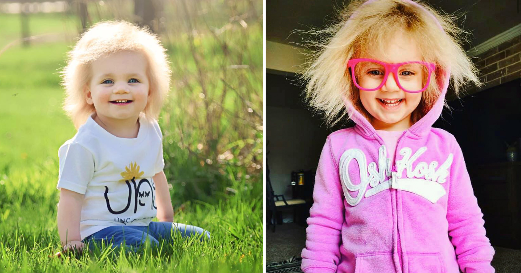 NextImg:Adorable girl with the nickname ‘Baby Einstein 2.0’ has blonde hair that grows in multiple directions