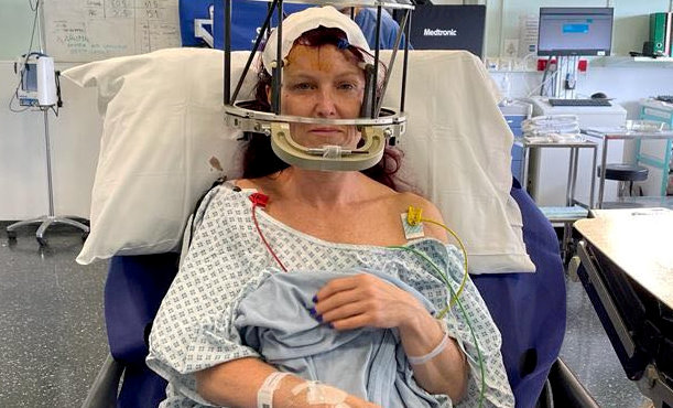 mum diagnosed with parkinson at 44 shares early symptoms
