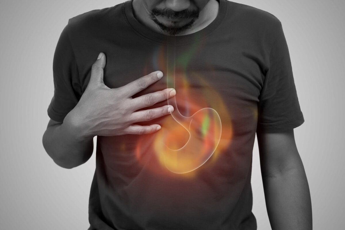 Relieve Acid Reflux with These Amazing Remedies.