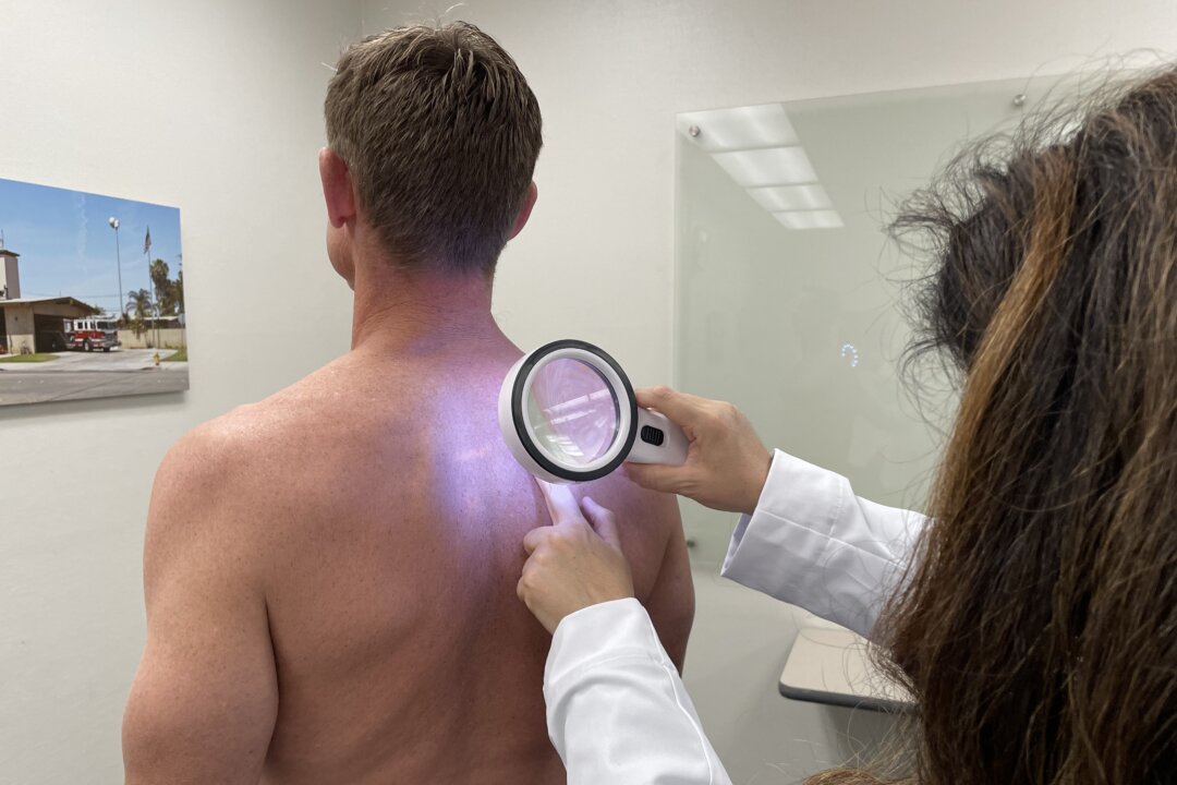 Dr. Tanya Evans from CalDerm is seen performing skin cancer spot screening on a firefighter in Huntington Beach, Calif., on April 30, 2023. (Sophie Li/The Epoch Times)